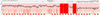 this is the same traceroute record from pingplotter (tracing to bbc.co.uk). It is very clear that at 8:40 and 8:50am ish today, I was disconnected from the internet for 2-10 minutes.